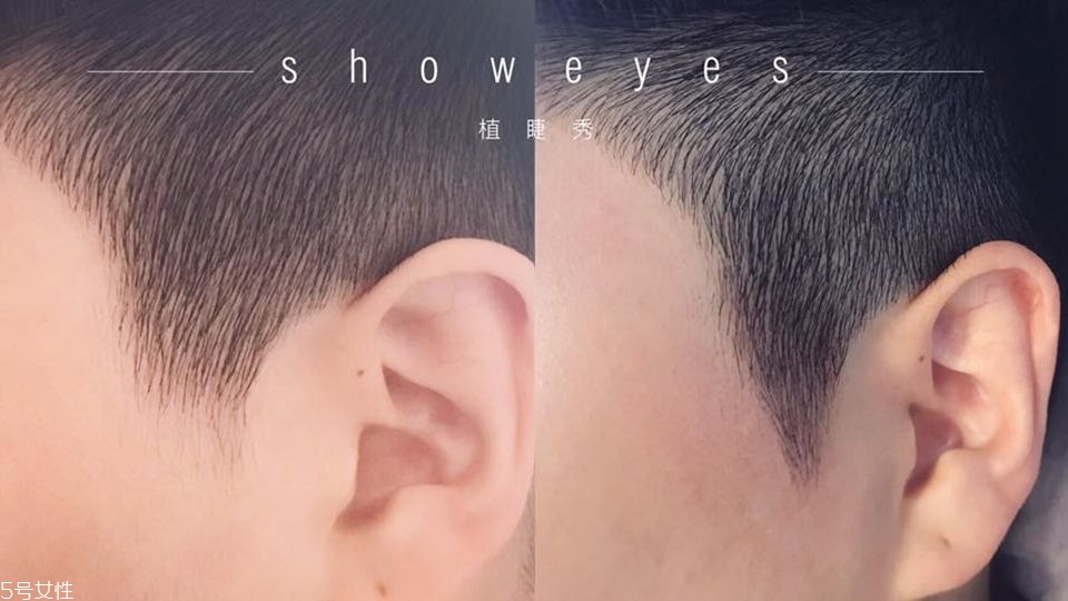 發(fā)量少怎么增加發(fā)量 禿發(fā)女孩必學(xué)發(fā)量激増6招 發(fā)量少怎么增加發(fā)量 禿發(fā)女孩必學(xué)發(fā)量激増6招