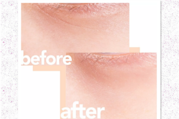 蘭蔻小黑瓶是什么功效 蘭蔻小黑瓶平價替代 蘭蔻小黑瓶是什么功效 蘭蔻小黑瓶平價替代