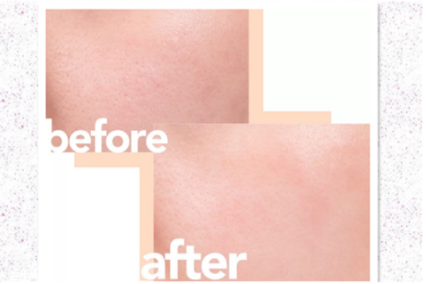 蘭蔻小黑瓶是什么功效 蘭蔻小黑瓶平價替代 蘭蔻小黑瓶是什么功效 蘭蔻小黑瓶平價替代