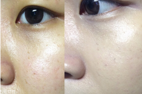 怎么選擇clio氣墊色號(hào) clio氣墊色號(hào)選擇 怎么選擇clio氣墊色號(hào) clio氣墊色號(hào)選擇