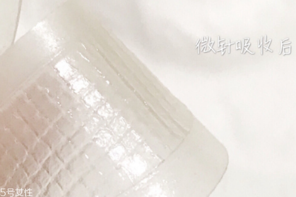 艾派絲微針怎么樣 艾派絲微針眼膜能過(guò)夜嗎 艾派絲微針怎么樣 艾派絲微針眼膜能過(guò)夜嗎