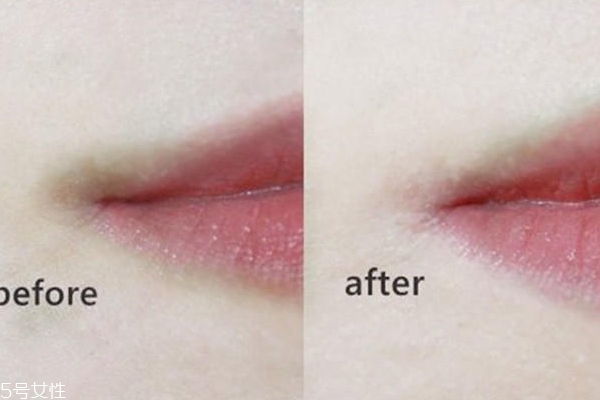 嘴角發(fā)黑怎么快速去除 這樣做不再顯得臟 嘴角發(fā)黑怎么快速去除 這樣做不再顯得臟