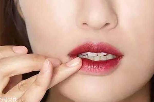 嘴角發(fā)黑怎么快速去除 這樣做不再顯得臟 嘴角發(fā)黑怎么快速去除 這樣做不再顯得臟