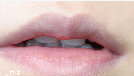 涂唇釉的方法 唇釉這樣涂最好看 涂唇釉的方法 唇釉這樣涂最好看