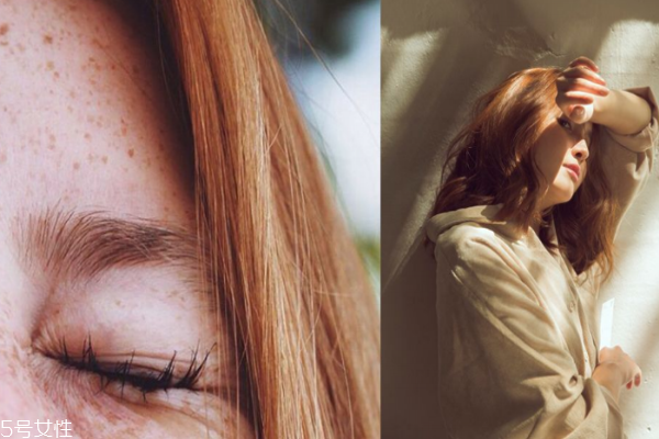 初秋怎么保養(yǎng)肌膚 夏天曬后黑化逆襲攻略 初秋怎么保養(yǎng)肌膚 夏天曬后黑化逆襲攻略