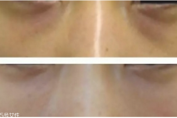 黑眼圈怎么遮瑕小竅門 底子不夠遮瑕來(lái)救