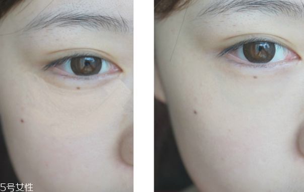 遮瑕筆和氣墊哪個(gè)先用 無(wú)暇底妝遮瑕一步搞定 遮瑕筆和氣墊哪個(gè)先用 無(wú)暇底妝遮瑕一步搞定