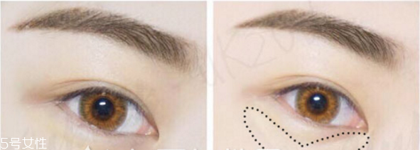 遮瑕筆和氣墊哪個(gè)先用 無(wú)暇底妝遮瑕一步搞定 遮瑕筆和氣墊哪個(gè)先用 無(wú)暇底妝遮瑕一步搞定