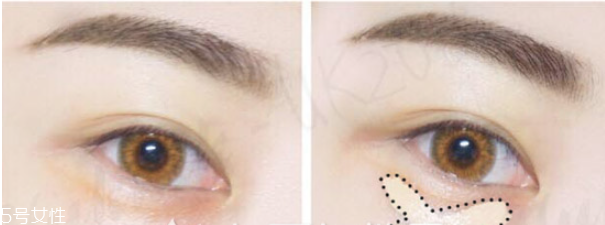 遮瑕筆和氣墊哪個(gè)先用 無(wú)暇底妝遮瑕一步搞定 遮瑕筆和氣墊哪個(gè)先用 無(wú)暇底妝遮瑕一步搞定