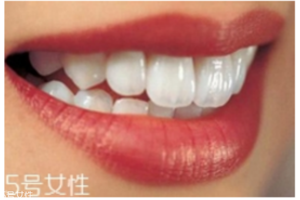 口臭的主因牙周病癥狀與治療 口臭的主因牙周病癥狀與治療