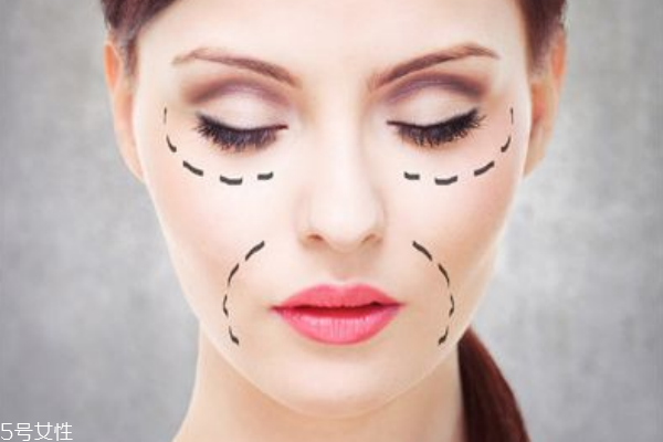 法令紋是什么東西 法令紋是什么東西