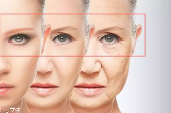 魚尾紋貼眼膜有用嗎 去眼部皺紋最好的眼膜 魚尾紋貼眼膜有用嗎 去眼部皺紋最好的眼膜