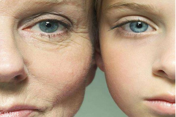 除皺針是什么 除皺針維持多久 除皺針是什么 除皺針維持多久