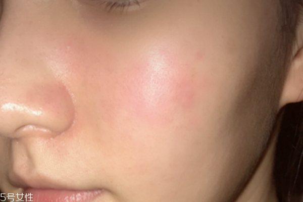 菲洛嘉修復(fù)霜適合年齡 抗敏感不挑年紀