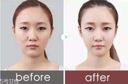 眼袋黑眼圈怎么消除 教你恢復(fù)魅力電眼 眼袋黑眼圈怎么消除 教你恢復(fù)魅力電眼