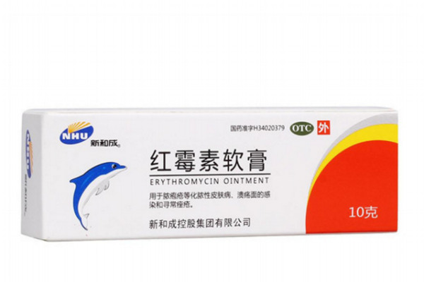 口角炎擦什么藥最好 小兒口角炎的治療方法 口角炎擦什么藥最好 小兒口角炎的治療方法