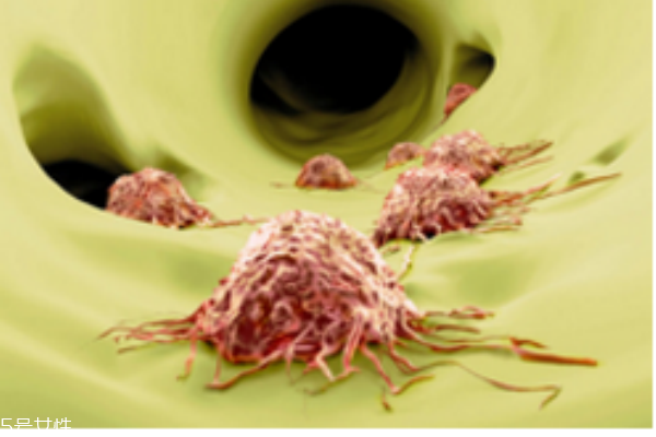 常見癌癥有哪些 生活習(xí)慣易引發(fā)癌癥 常見癌癥有哪些 生活習(xí)慣易引發(fā)癌癥