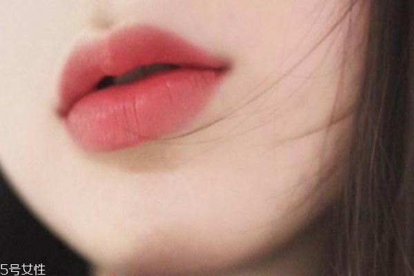 口紅病是什么樣的 發(fā)生幾率很小 口紅病是什么樣的 發(fā)生幾率很小