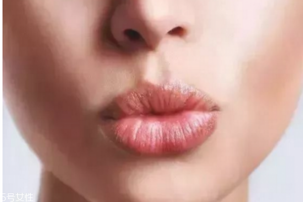 冬季如何護唇 護唇小妙招 冬季如何護唇 護唇小妙招