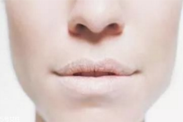 冬季如何護唇 護唇小妙招 冬季如何護唇 護唇小妙招