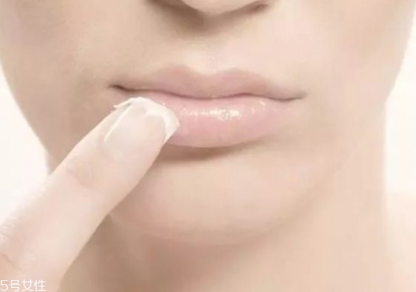 冬季如何護唇 護唇小妙招 冬季如何護唇 護唇小妙招