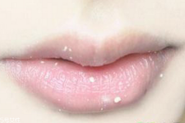 冬季如何護唇 護唇小妙招 冬季如何護唇 護唇小妙招