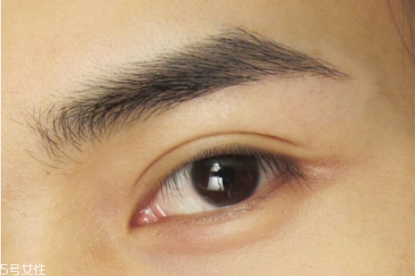 雙眼皮貼老是翻出來(lái)怎么辦 貼出自然持久雙眼皮