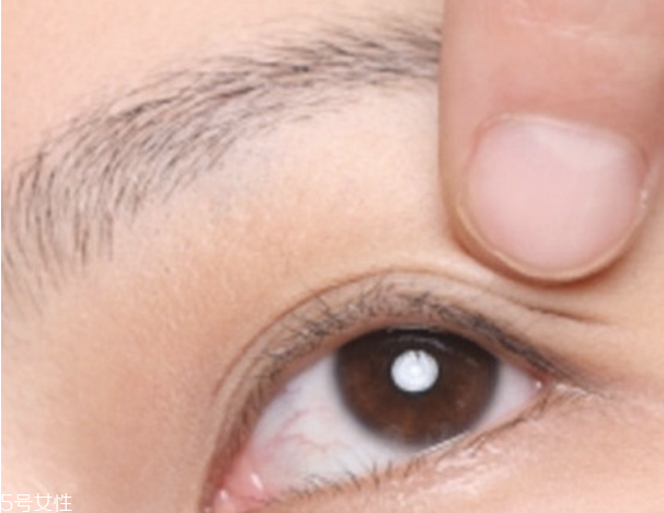 雙眼皮貼老是翻出來(lái)怎么辦 貼出自然持久雙眼皮