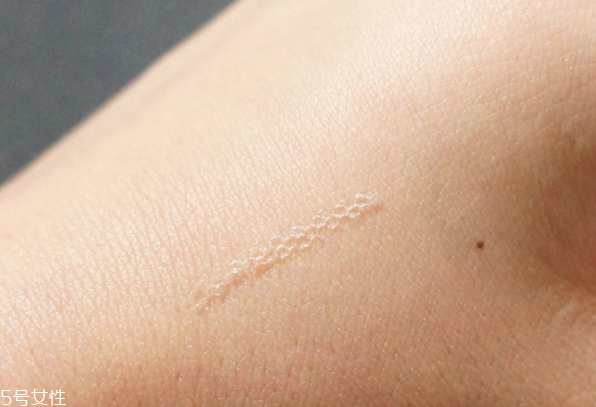 雙眼皮貼老是翻出來(lái)怎么辦 貼出自然持久雙眼皮