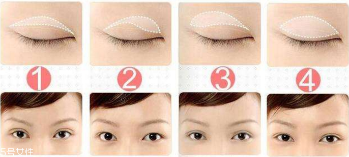 雙眼皮貼怎么選 十種雙眼皮貼全介紹 雙眼皮貼怎么選 十種雙眼皮貼全介紹