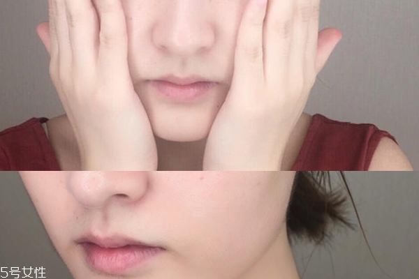 海藍(lán)之謎面霜能祛痘嗎 痘肌1周使用報(bào)告 海藍(lán)之謎面霜能祛痘嗎 痘肌1周使用報(bào)告