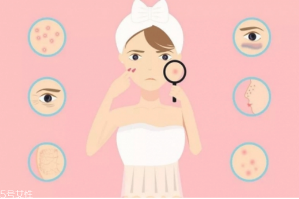 什么皮膚需要去角質(zhì) 深層清潔不是所有人都適合 什么皮膚需要去角質(zhì) 深層清潔不是所有人都適合