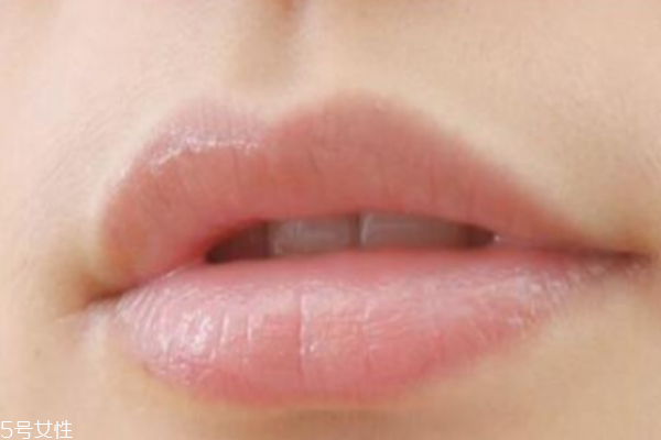 唇毛過重什么原因 2個(gè)因素自測(cè)一下 唇毛過重什么原因 2個(gè)因素自測(cè)一下