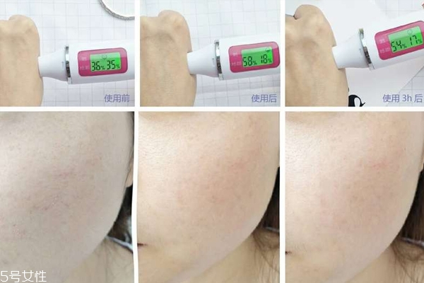 瑞鉑希精華素好用嗎 貴有貴的理由 瑞鉑希精華素好用嗎 貴有貴的理由