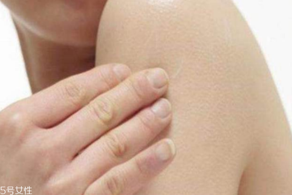 身體需要去角質(zhì)嗎 四個征兆告訴你 身體需要去角質(zhì)嗎 四個征兆告訴你