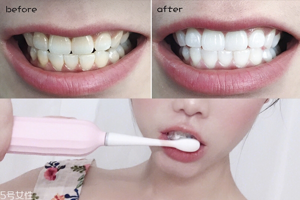 佳潔士美白牙膏含氟嗎 含氟牙膏不怕蛀牙 佳潔士美白牙膏含氟嗎 含氟牙膏不怕蛀牙