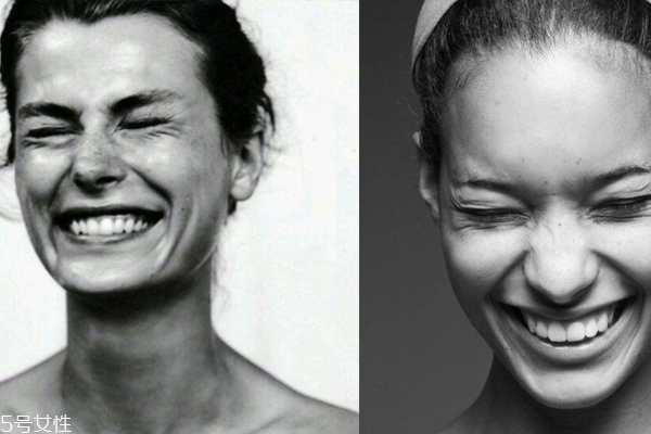 法令紋形成是什么原因 3種類型令顏值掉線 法令紋形成是什么原因 3種類型令顏值掉線