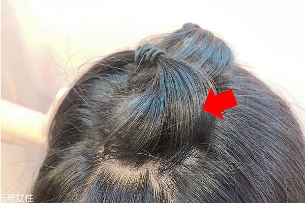 發(fā)量少怎么扎馬尾圖解 2招拯救微禿女孩 發(fā)量少怎么扎馬尾圖解 2招拯救微禿女孩
