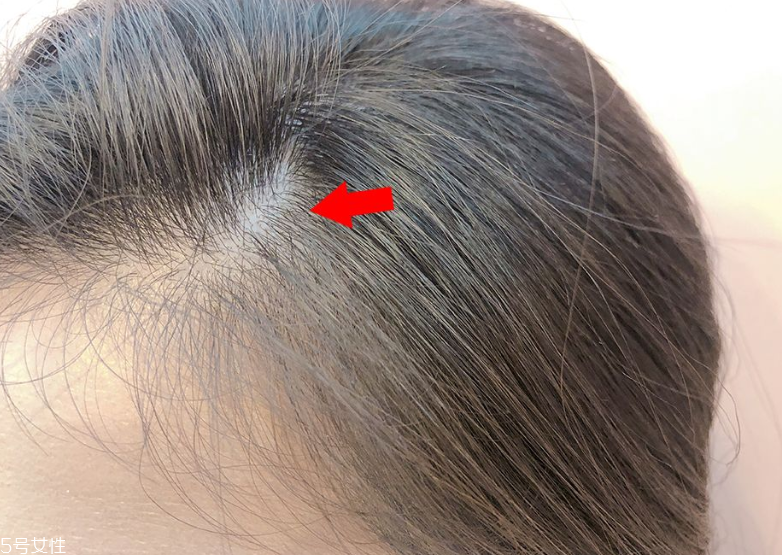 發(fā)量少怎么扎馬尾圖解 2招拯救微禿女孩 發(fā)量少怎么扎馬尾圖解 2招拯救微禿女孩