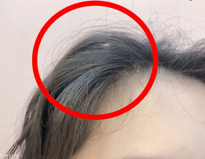 發(fā)量少怎么扎馬尾圖解 2招拯救微禿女孩 發(fā)量少怎么扎馬尾圖解 2招拯救微禿女孩