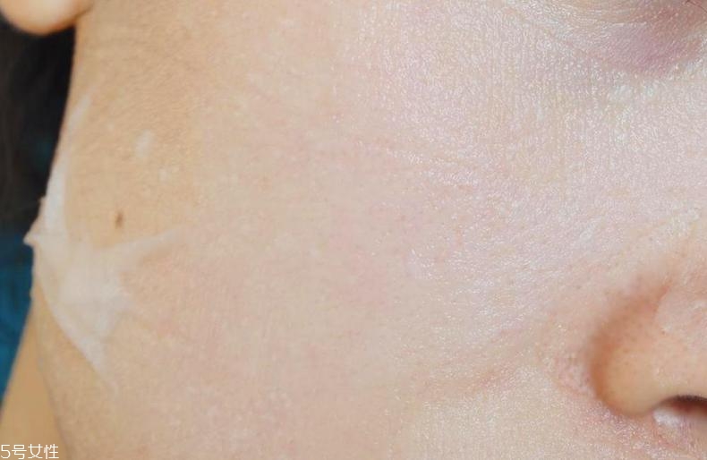 薇諾娜舒敏面膜免洗嗎 薇諾娜舒敏面膜怎么樣 薇諾娜舒敏面膜免洗嗎 薇諾娜舒敏面膜怎么樣