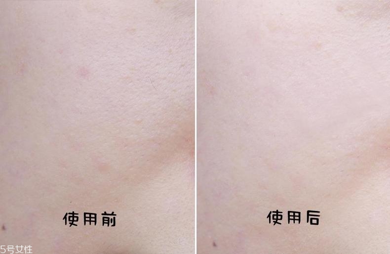 薇諾娜舒敏面膜免洗嗎 薇諾娜舒敏面膜怎么樣 薇諾娜舒敏面膜免洗嗎 薇諾娜舒敏面膜怎么樣