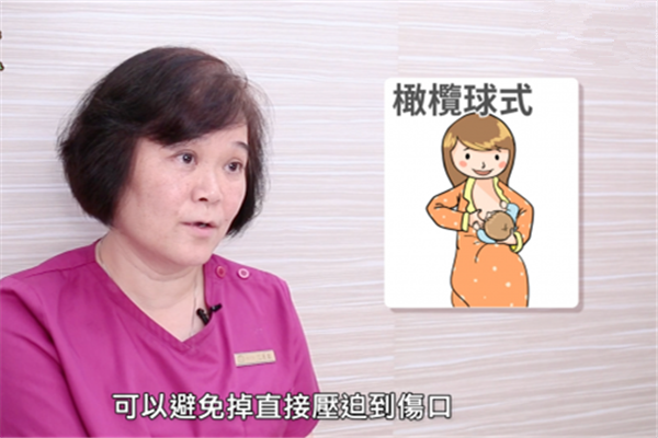 順產(chǎn)和剖腹產(chǎn)哪個更痛 產(chǎn)后傷口護理有不同 順產(chǎn)和剖腹產(chǎn)哪個更痛 產(chǎn)后傷口護理有不同