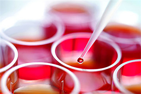 血管類疾病有哪些 7種癥狀告訴你血管有問題 血管類疾病有哪些 7種癥狀告訴你血管有問題