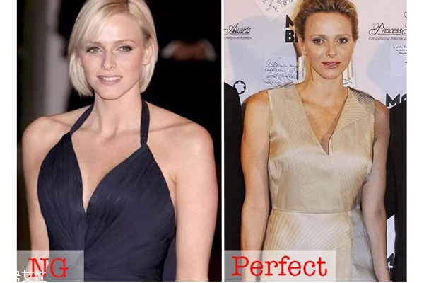 肩寬穿什么樣的吊帶 注意4點不會顯胖 肩寬穿什么樣的吊帶 注意4點不會顯胖