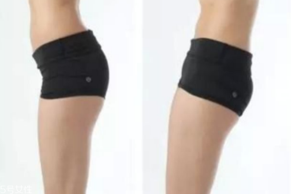 大腿前側(cè)肉多什么原因 弄懂原理根本解決 大腿前側(cè)肉多什么原因 弄懂原理根本解決