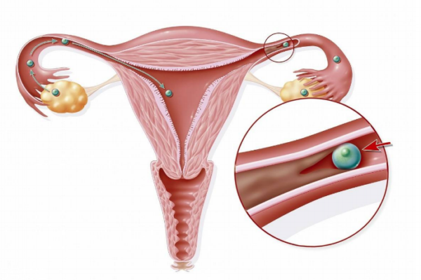女性卵巢保養(yǎng)有效快速的方法有七點 女性卵巢保養(yǎng)有效快速的方法有七點