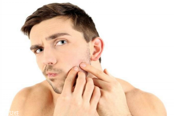 男士要去雀斑嗎 男士去雀斑產(chǎn)品推薦 男士要去雀斑嗎 男士去雀斑產(chǎn)品推薦