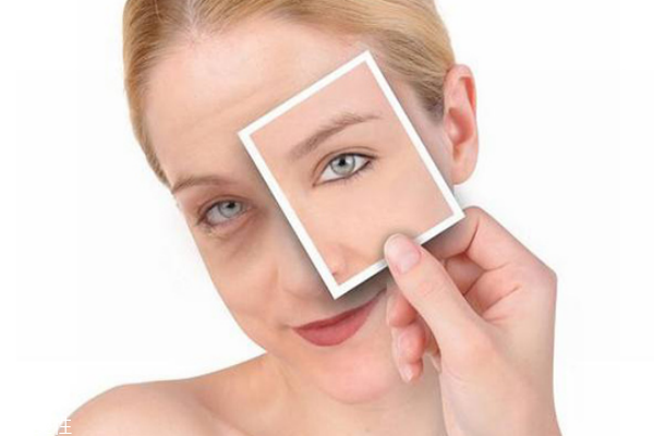 果酸身體乳可以涂臉嗎 果酸身體乳的危害 果酸身體乳可以涂臉嗎 果酸身體乳的危害