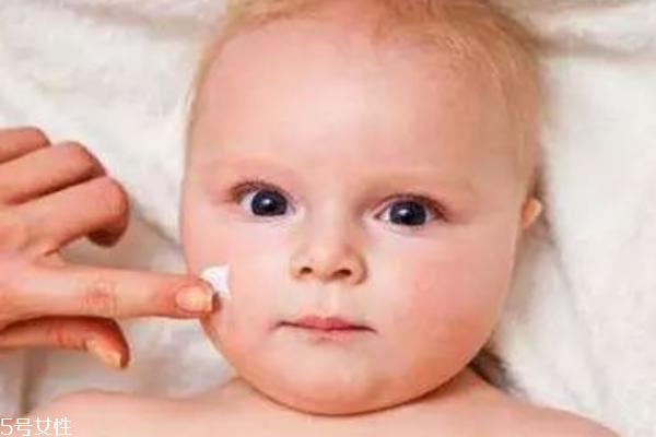 寶寶濕疹怎么辦 生活上要注意 寶寶濕疹怎么辦 生活上要注意